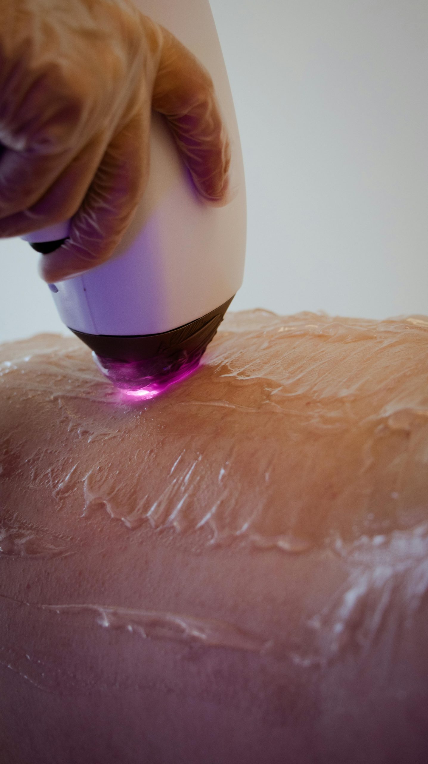 Revive Beauty Solutions LaserCleopatra Laser