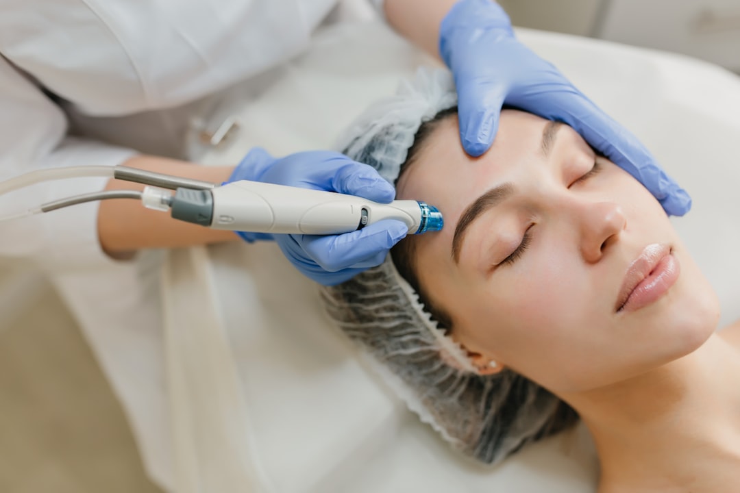 Microneedling treatment image representing Emmrey Medical Aesthetics