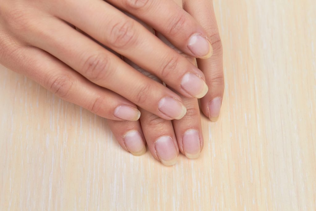 Female hands with not polished nails. Woman hands without gel on nails. Young woman hands before having manicure.